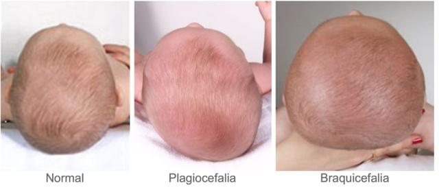 81189-COJIN JANE PLAGIOCEFALIA(30-5)-2